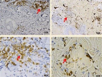 Model bolesti neljudskih primata odgođene preosjetljivosti (DTH).